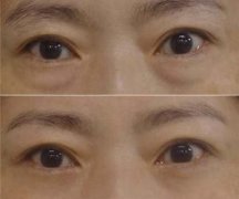 ���ͺ����۲���֬������ʲô����