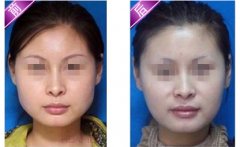 ���ͺ���ȥ�a֬�|���g(sh��)���а̺ۆ᣿