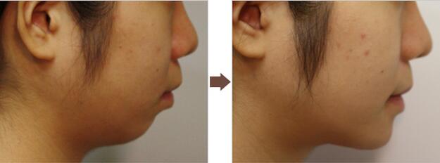 u=3759467054,1724259152&fm=26&gp=0