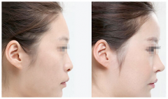 ���ͺ�����֬�����m����Ⱥ����Щ��