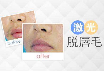 呼市整形醫(yī)院