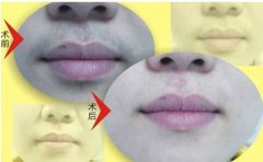 ���ⴽ��Óë��(du��)���w�Гp�������