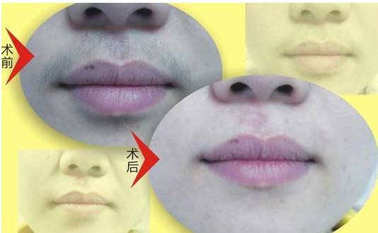 呼市整形醫(yī)院