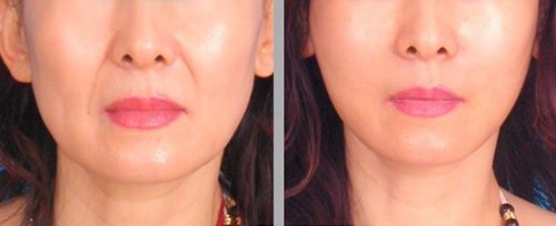 呼市整形醫(yī)院