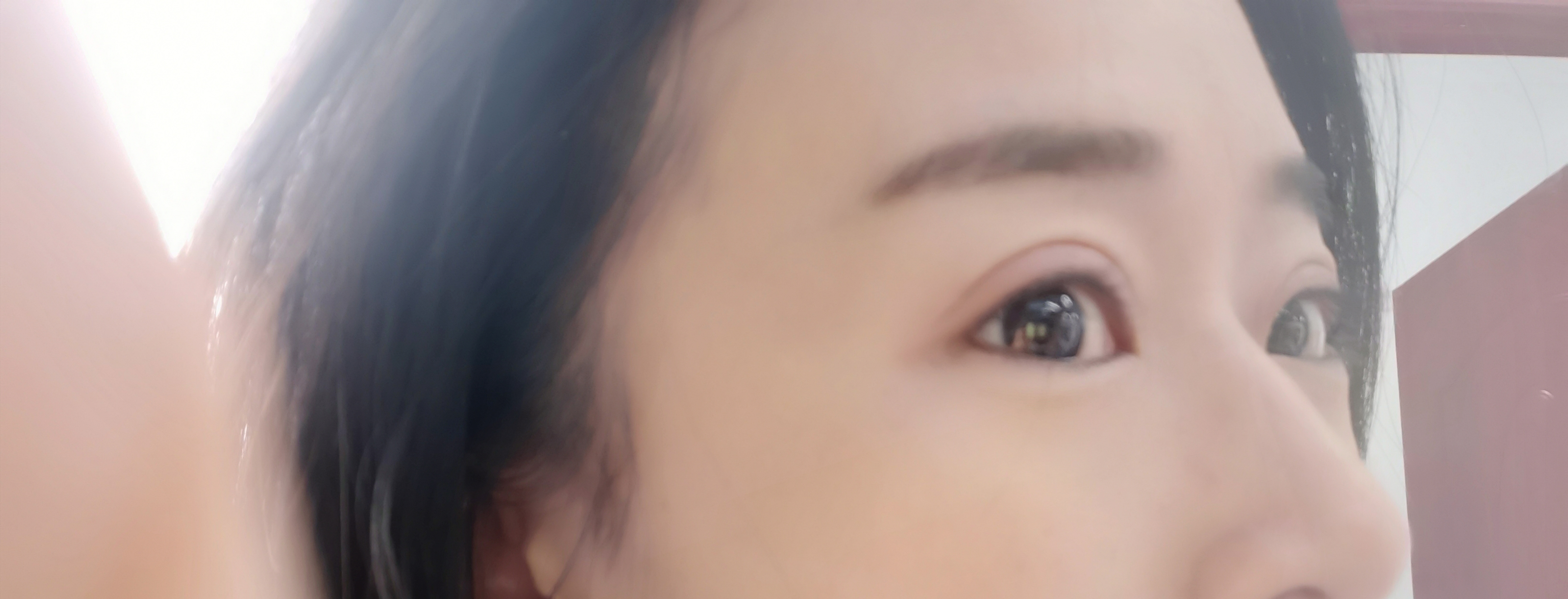 呼市整形醫(yī)院雙眼皮