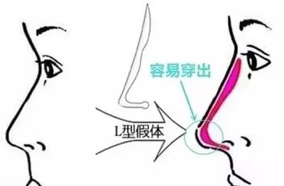 呼市整形醫(yī)院