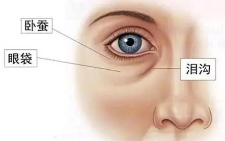 呼市整形有淚溝怎么辦