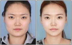 ���M��ĥ�����g(sh��)�r(ji��)���Ƕ���