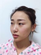 ���ͺ������沿��֬�����g��������Щ��